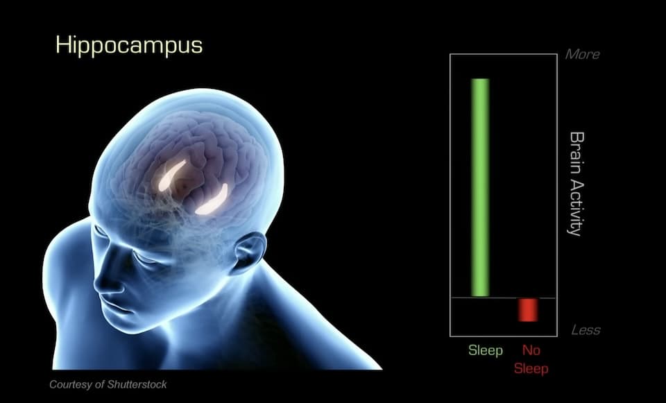 수면 부족시 해마 활동 저하